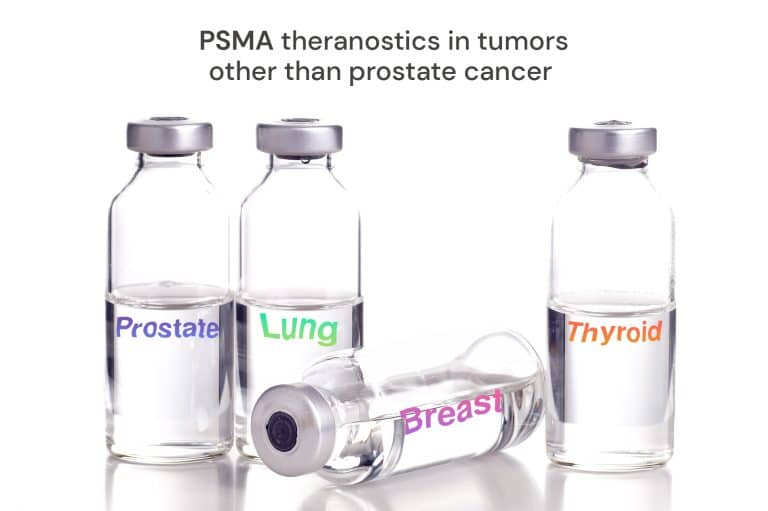 Psma Theranostics In Tumors Other Than Prostate Cancer Isotopia